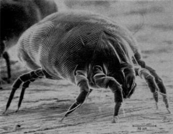 Dust mite under electron microscope